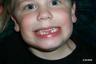 Ben's Tooth